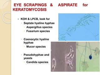 EYE SCRAPINGS & ASPIRATE for
KERATOMYCOSIS
 KOH & LPCB, look for
◦ Septate hyaline hyphae
 Aspergillus species
 Fusarium species
◦ Coenocytic hyaline
hyphae
 Mucor species
◦ Pseudohyphae and
yeasts
 Candida species
 