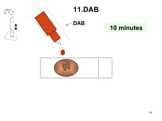 DAB 11.DAB 10 minutes 