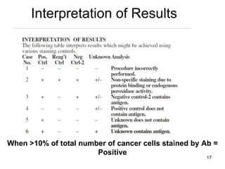 Interpretation of Results When >10% of total number of cancer cells stained by Ab = Positive 