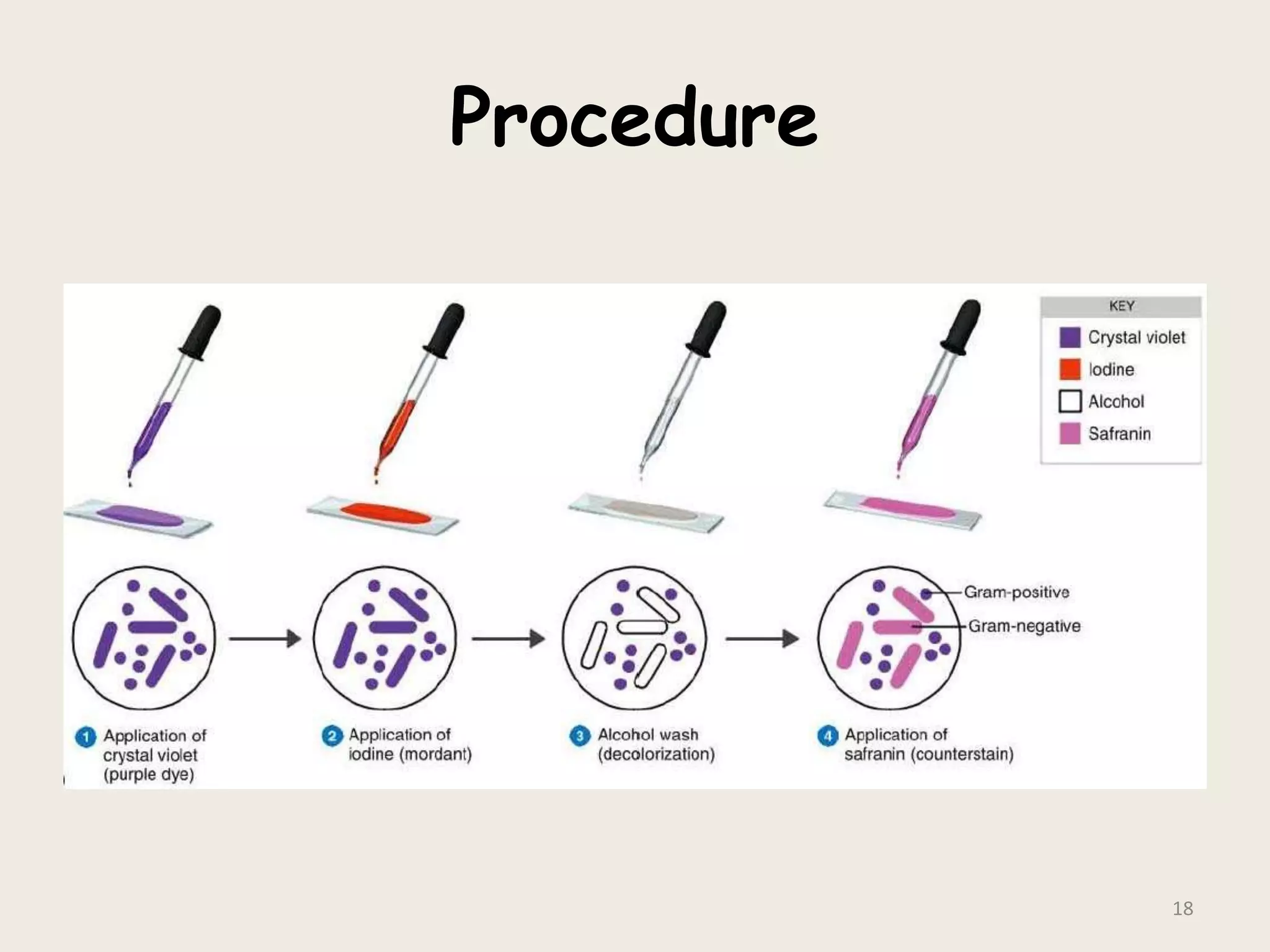 Procedure
18
 