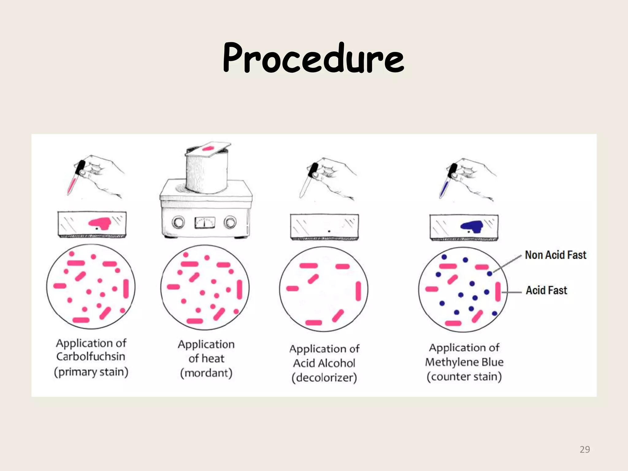 Procedure
29
 