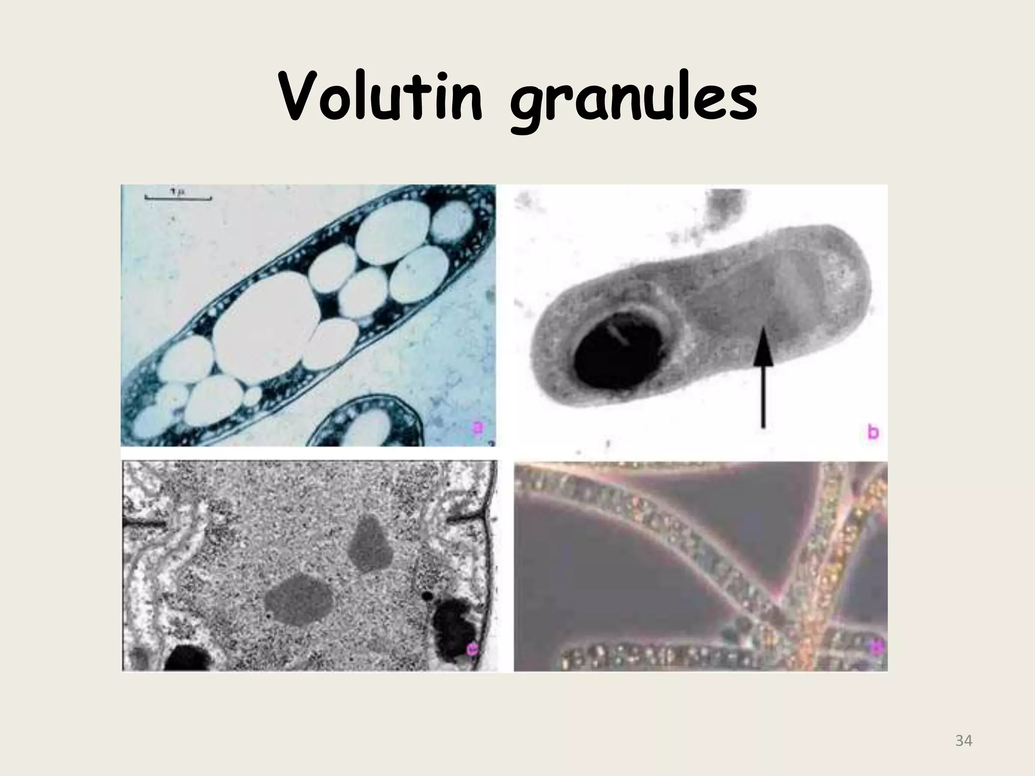 Volutin granules
34
 