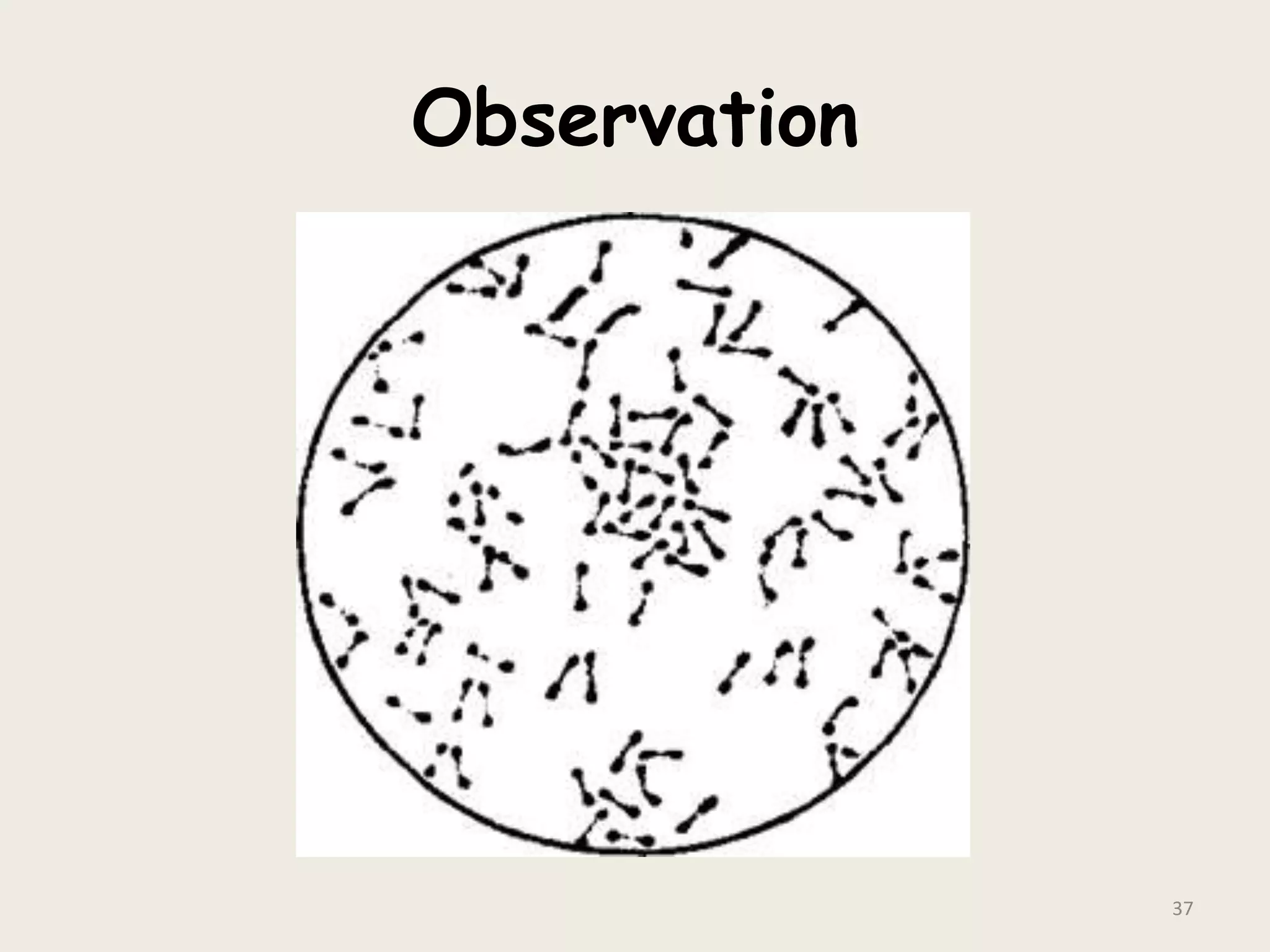 Observation
37
 