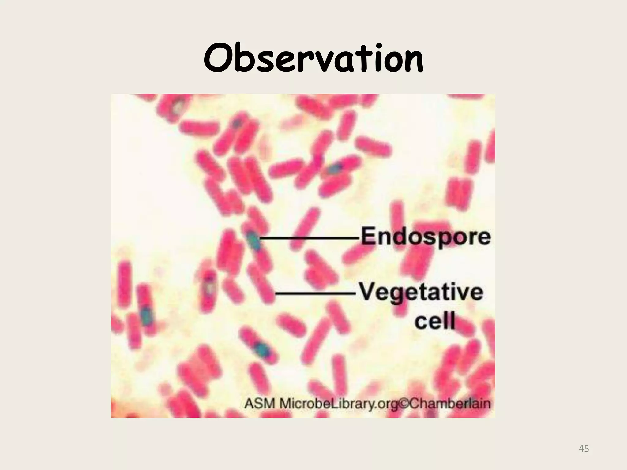 Observation
45
 