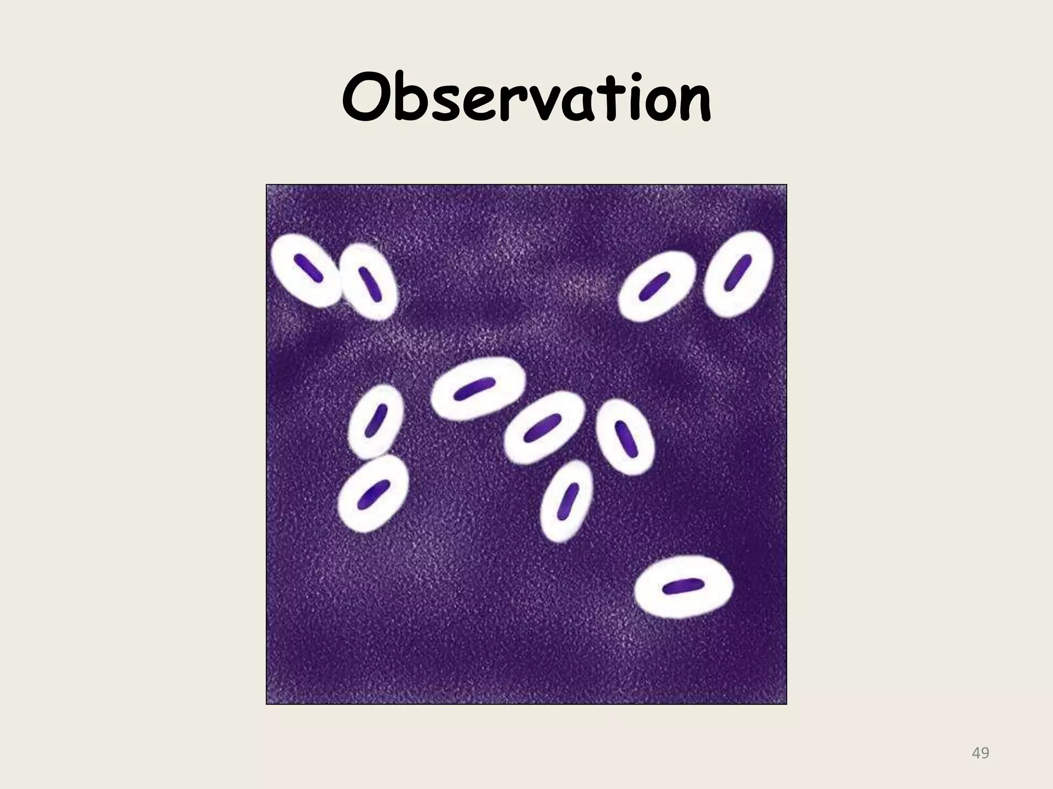 Observation
49
 