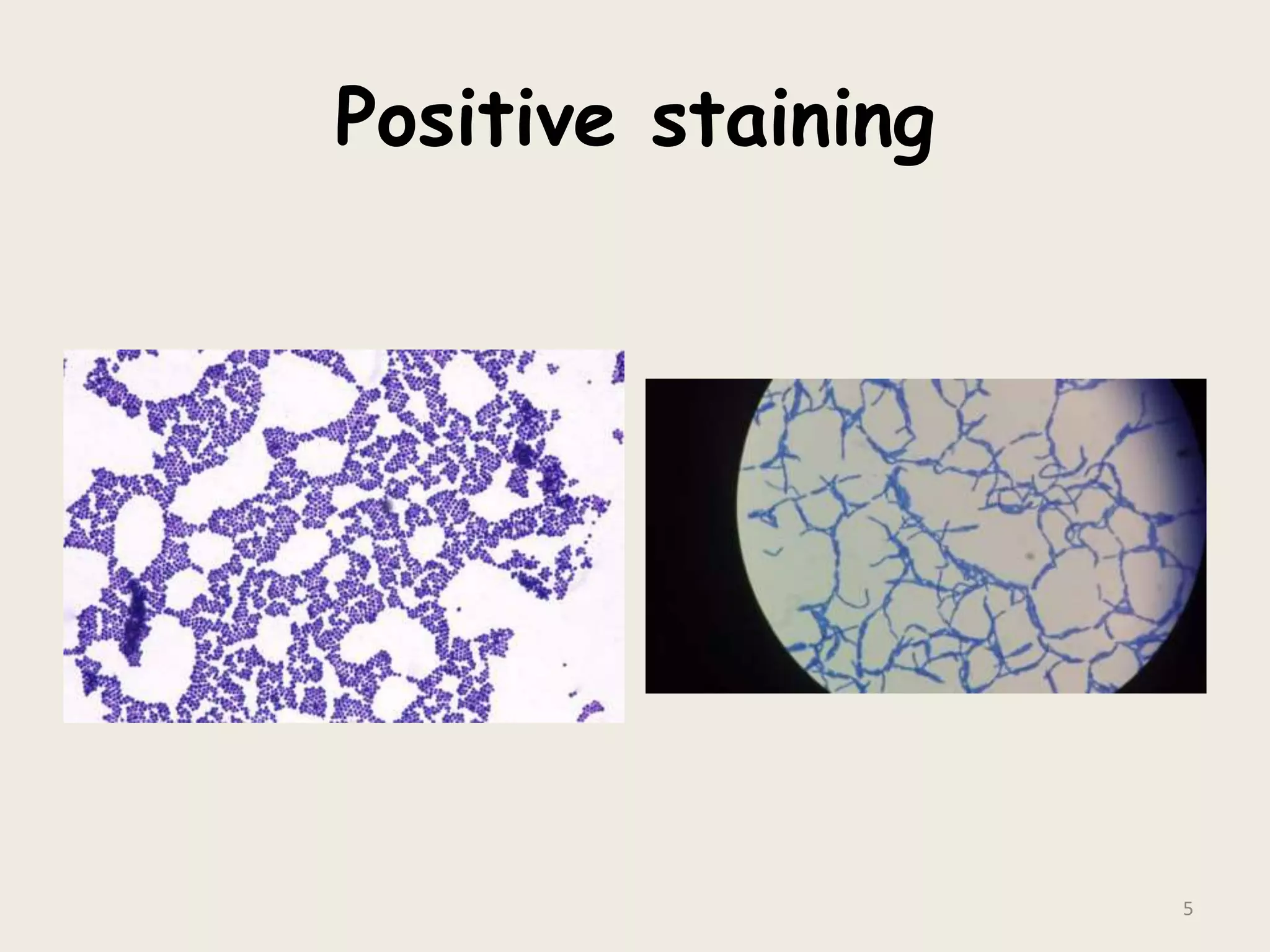 Positive staining
5
 