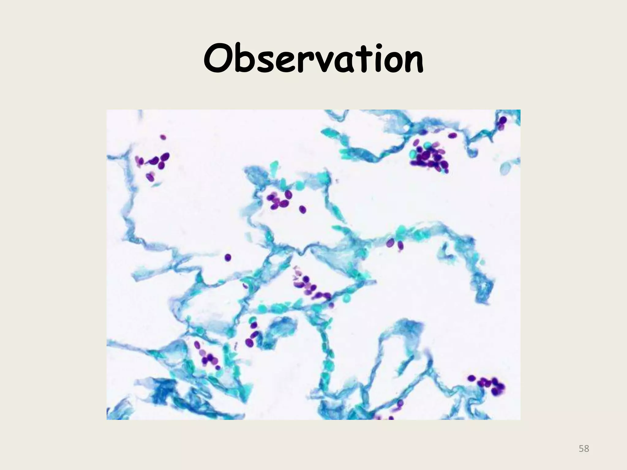 Observation
58
 