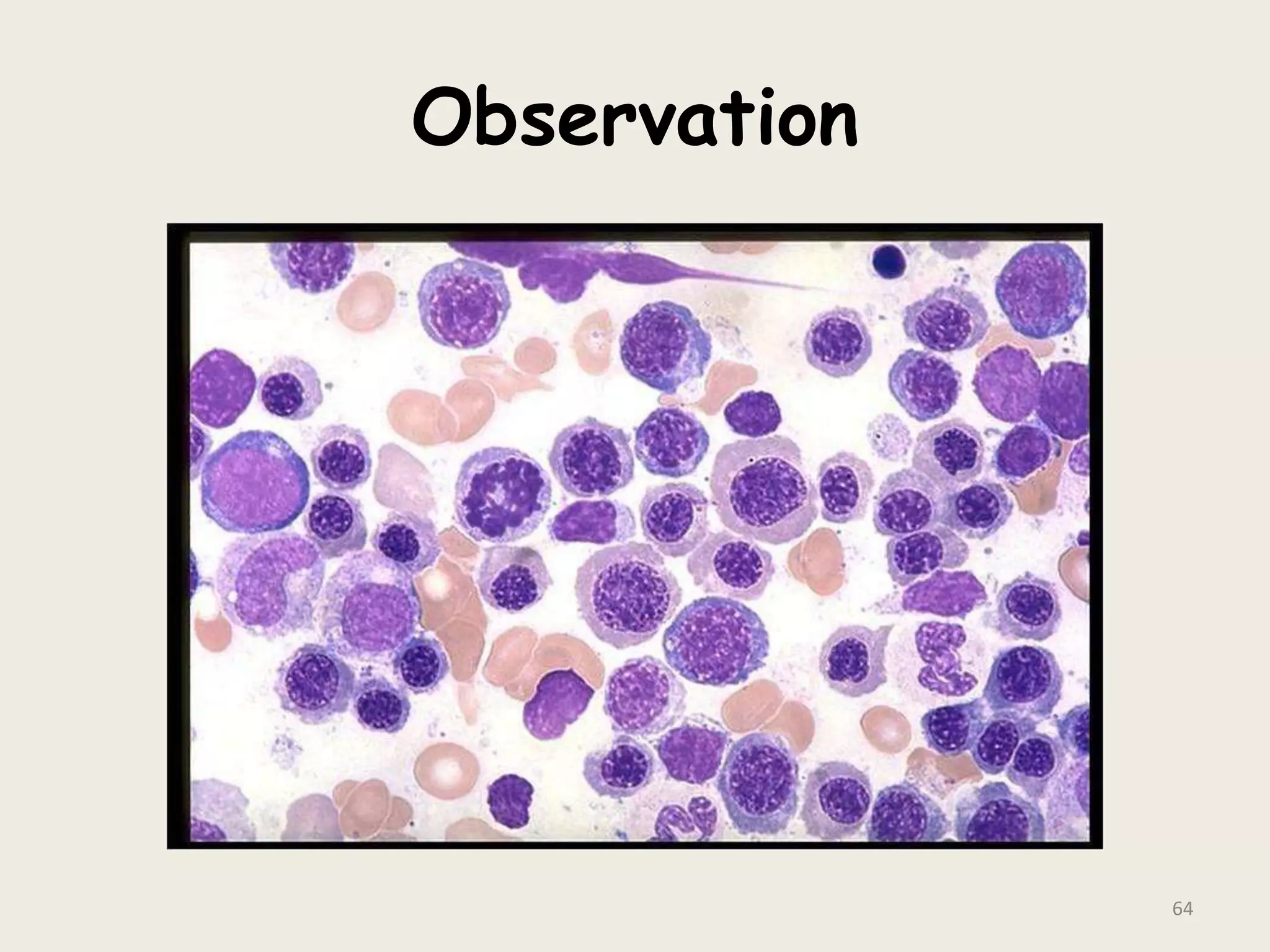 Observation
64
 