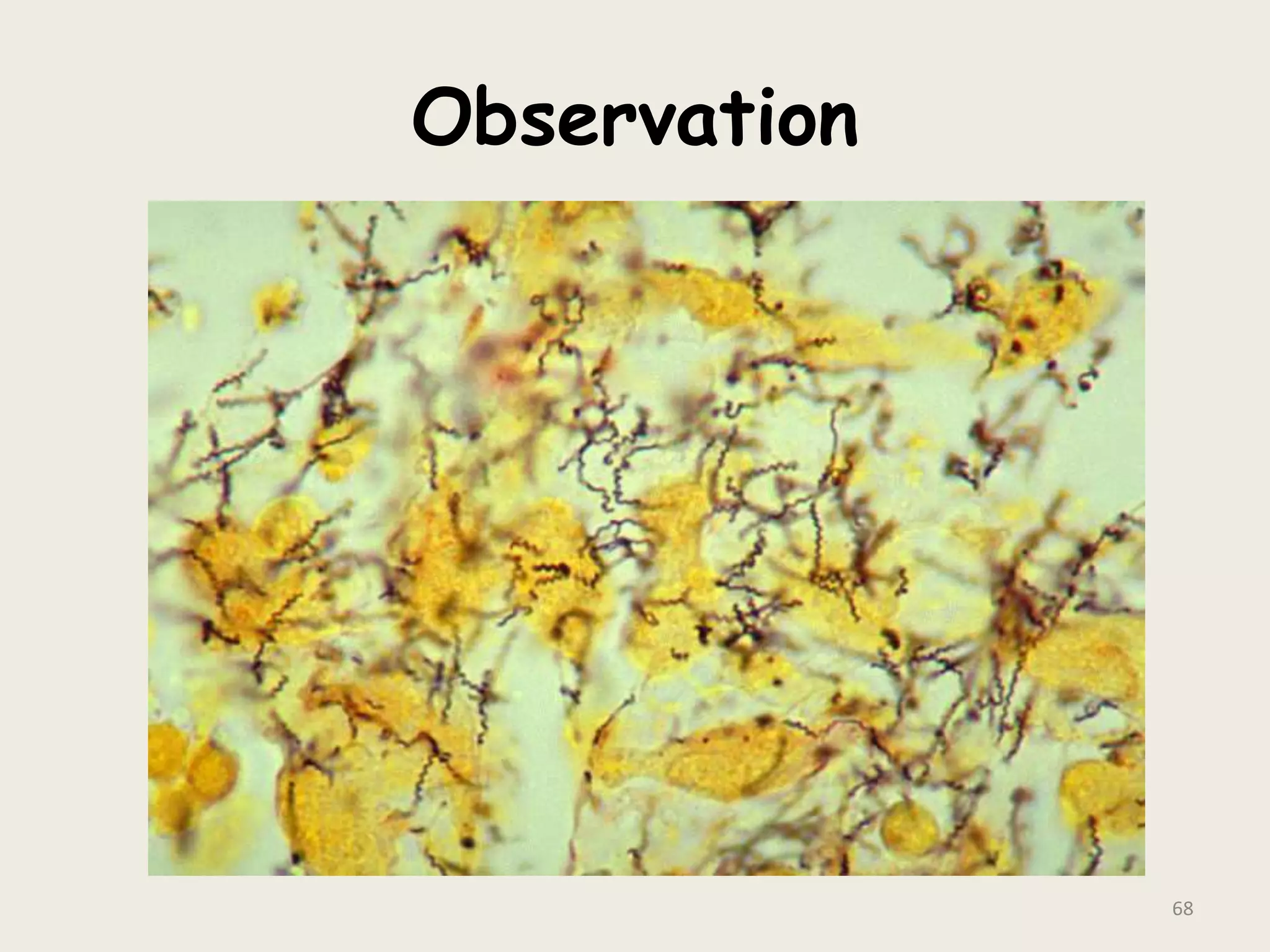 Observation
68
 