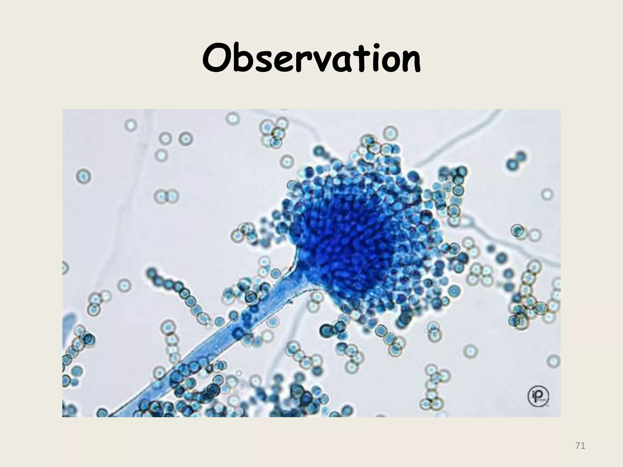 Observation
71
 