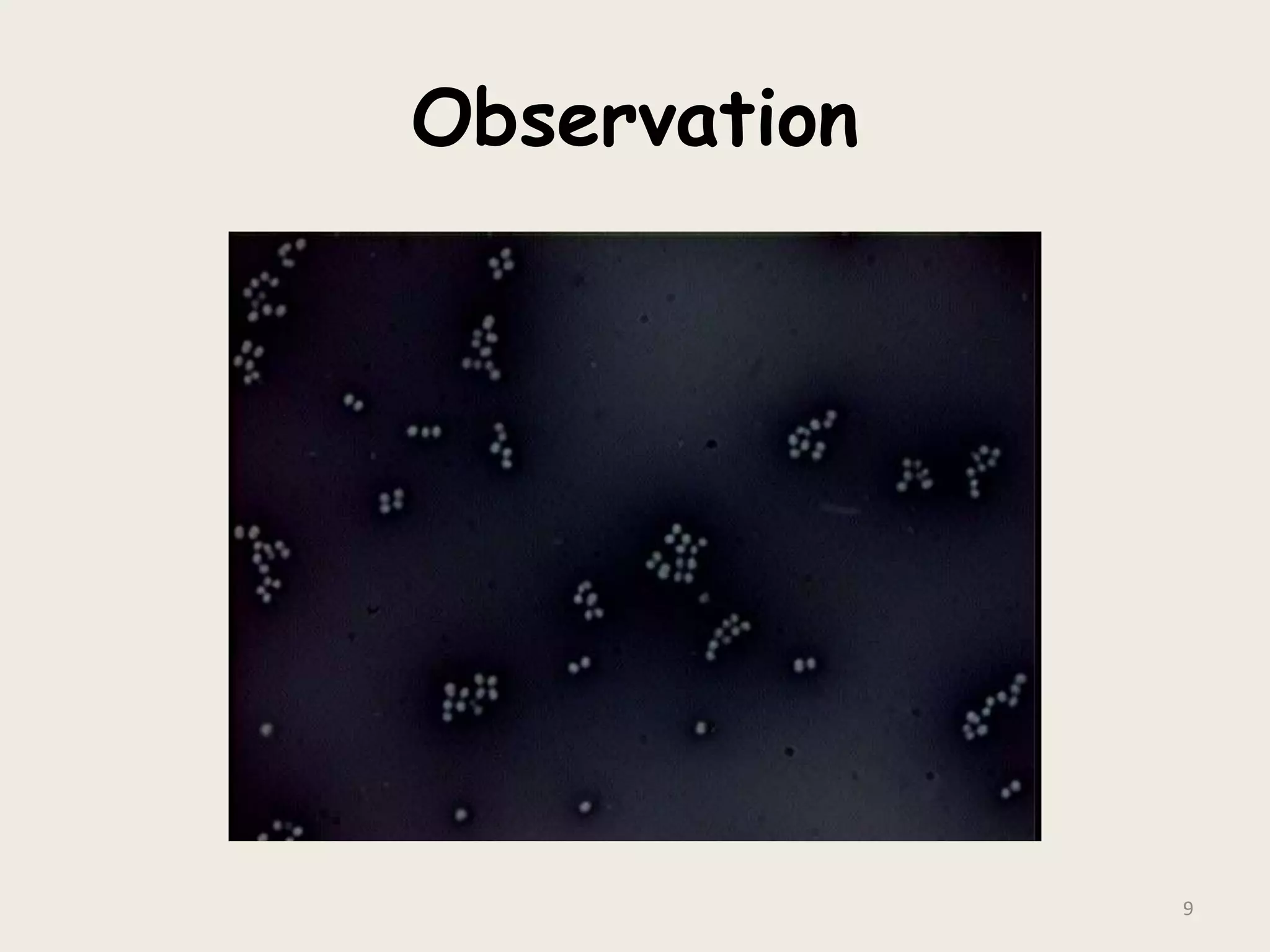 Observation
9
 