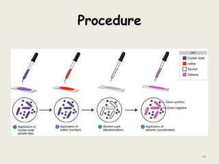 Procedure
18
 