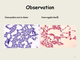 Observation
Grampositive cocci in chains Gramnegative bacilli
19
 