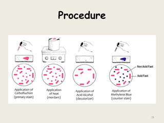 Procedure
29
 
