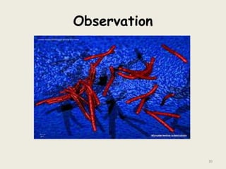 Observation
30
 