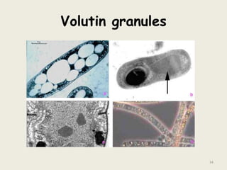Volutin granules
34
 