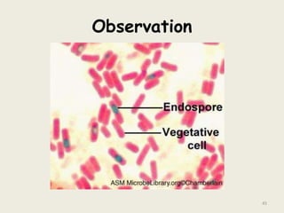 Observation
45
 