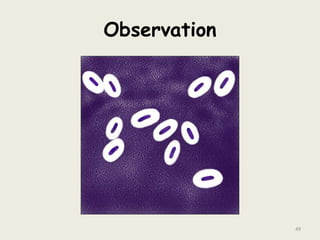 Observation
49
 