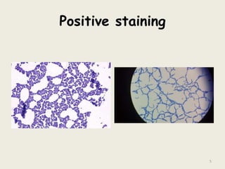 Positive staining
5
 