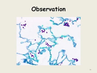 Observation
58
 