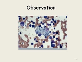 Observation
61
 
