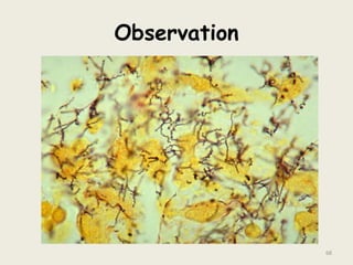 Observation
68
 