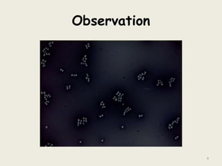 Observation
9
 