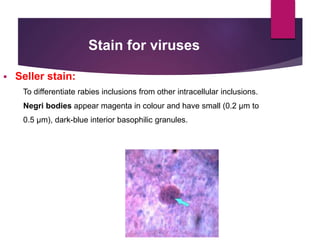 Rabies Inclusions STAINING TECHNIQUES.pptx