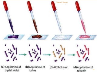Staining Examples Staining techniques bacteria... | PPTX