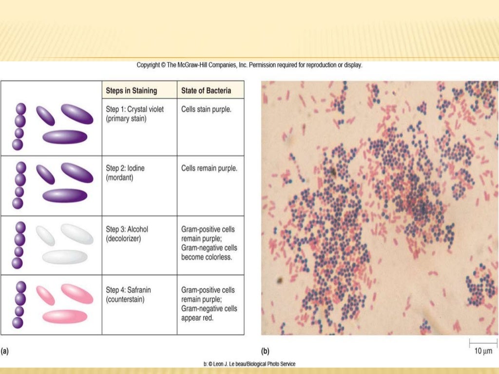 Complex Staining Types Types Of Staining Techniques In Microbiology – FUPH