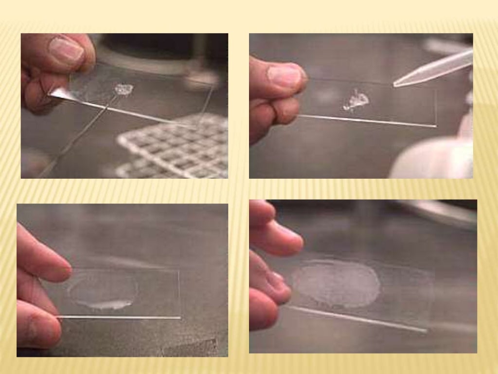 Staining Techniques in Microbiology