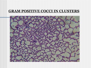 GRAM POSITIVE COCCI IN CLUSTERS
 