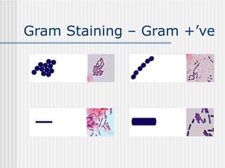 Gram Staining – Gram +’ve
 