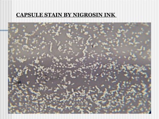 CAPSULE STAIN BY NIGROSIN INK
 