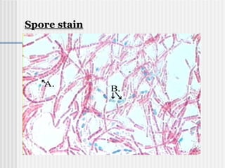 Spore stain
 