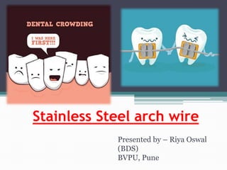 Stainless Steel arch wire
Presented by – Riya Oswal
(BDS)
BVPU, Pune
 