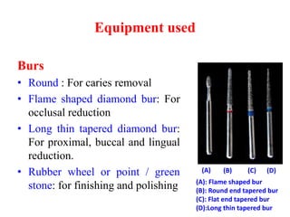 Equipment used
Burs
• Round : For caries removal
• Flame shaped diamond bur: For
occlusal reduction
• Long thin tapered diamond bur:
For proximal, buccal and lingual
reduction.
• Rubber wheel or point / green
stone: for finishing and polishing (A): Flame shaped bur
(B): Round end tapered bur
(C): Flat end tapered bur
(D):Long thin tapered bur
(A) (B) (C) (D)
 