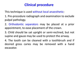 Clinical procedure
This technique is used without local anaesthetic:
1. Pre-procedure radiograph and examination to exclude
pulpal pathology.
2. Orthodontic separators may be placed at a prior
appointment, to ease placement of the crown.
3. Child should be sat upright or semi-reclined, but not
supine and gauze may be used to protect the airway.
4. The tooth can be cleaned with a toothbrush and if
desired gross caries may be removed with a hand
excavator.
 