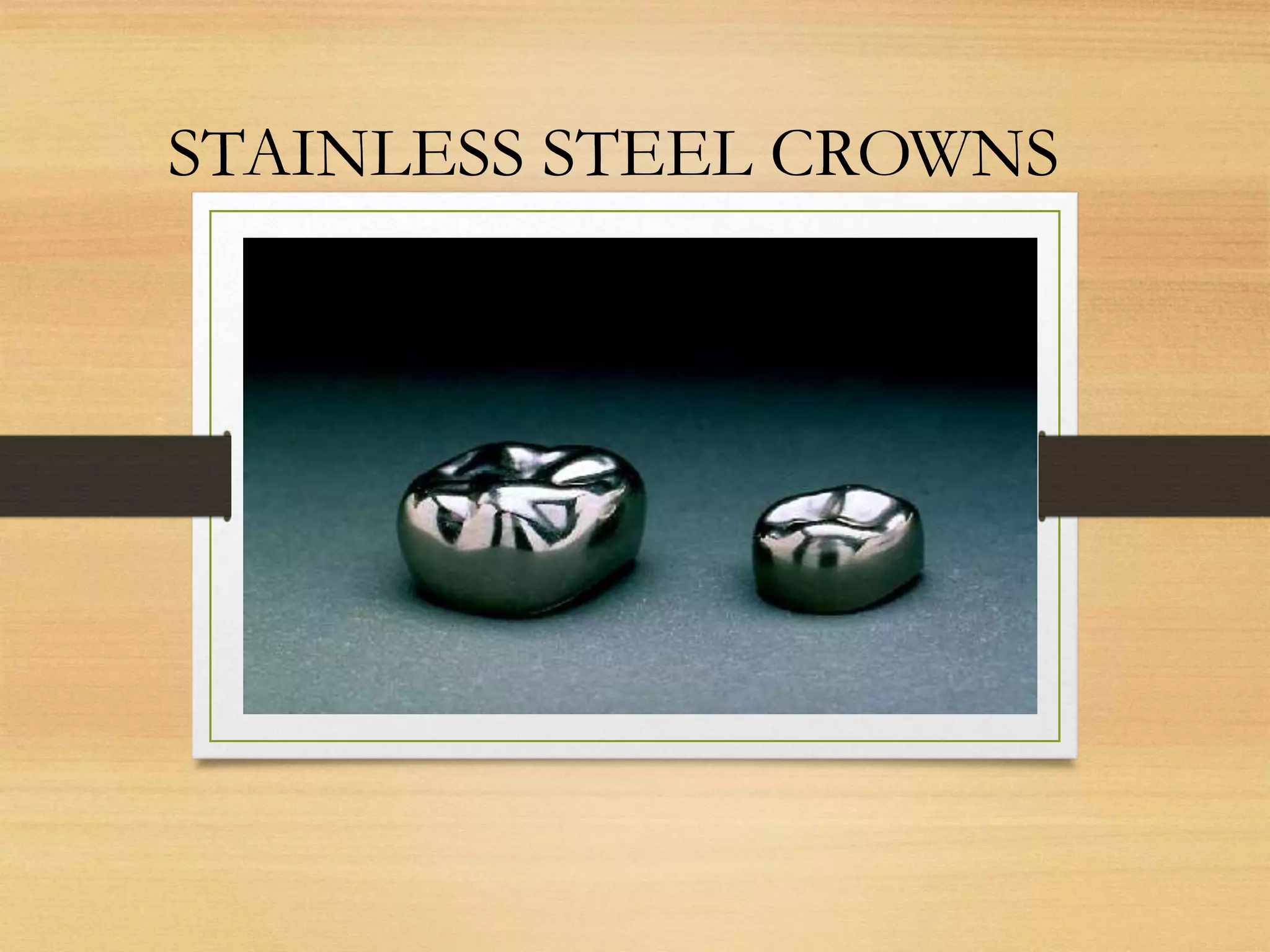 Ss Crown Instruments Stainless steel crowns | PPT