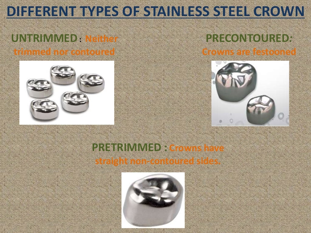 Stainless Steel Crowns PEDODONTICS stainless-steel-crowns-pedodontics