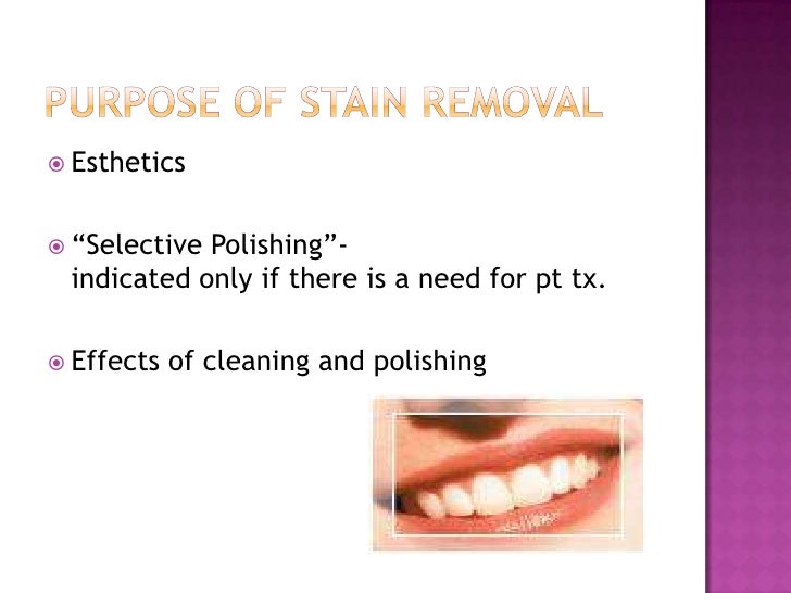 Stain removal ppt 1 edtc 6358