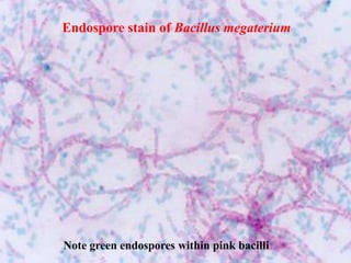 Note green endospores within pink bacilli
Endospore stain of Bacillus megaterium
 