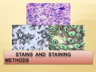 STAINS AND STAINING
METHODS
 