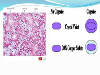 Capping Staining Patterns Stains and staining techniques | PPTX