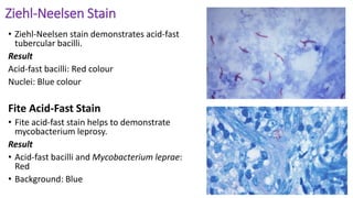 STAINS IN HISTOPATHOLOGY pptx stains-in-histopathology-pptx