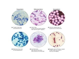 Ri Staining Pattern Staining techniques in microbiology .ppt