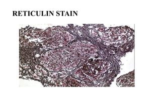 Stains Used in Histopathology and Uses [Autosaved].pptx
