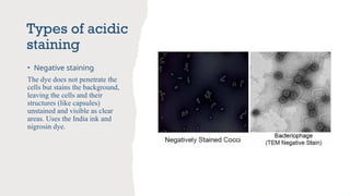Stains Used in Microbiology for diagnosis of clinical samples | PPTX