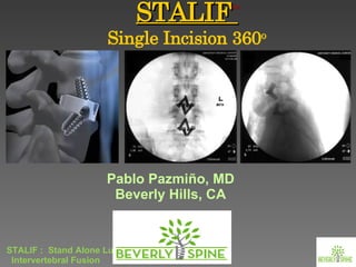 STALIF  Single Incision 360 o TM Pablo Pazmiño, MD Beverly Hills, CA 