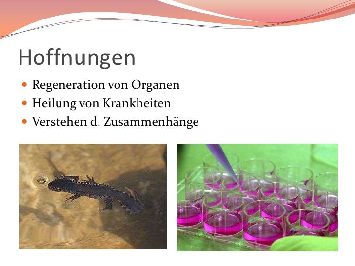 Konnen Stammzellen Leben Retten